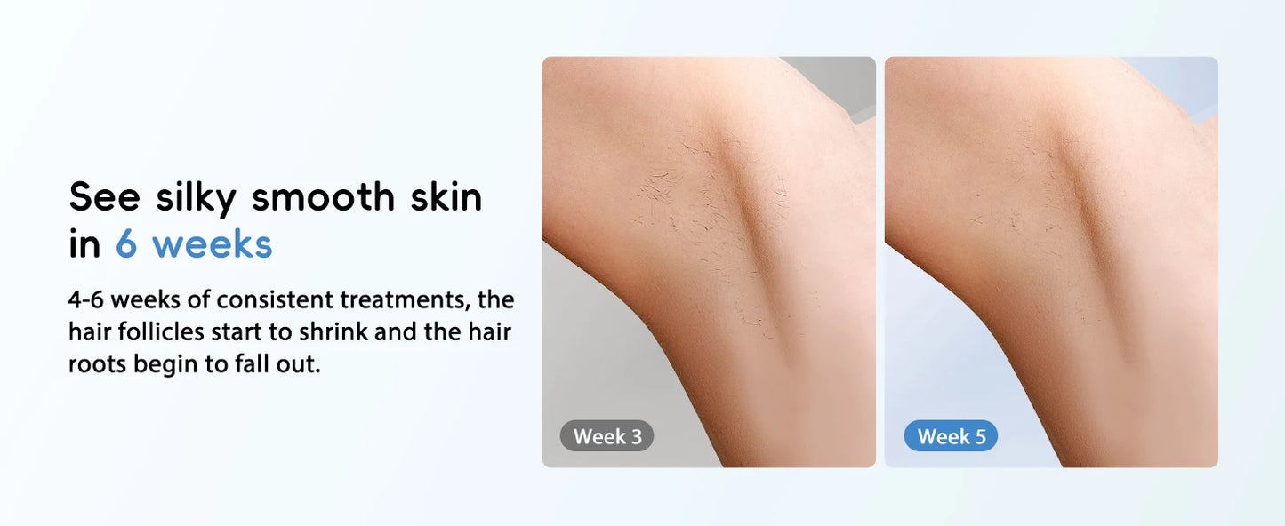 Hair Removal Laser IPL 22J Unlimited IGBT 5.2 cm² light Quick Flashes Painless Epilator Face Armpit Bikini Treament Boay Laser
