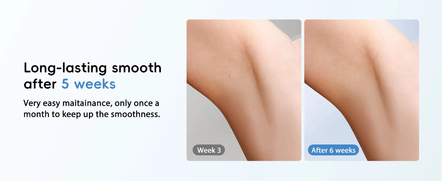 Hair Removal Laser IPL 22J Unlimited IGBT 5.2 cm² light Quick Flashes Painless Epilator Face Armpit Bikini Treament Boay Laser